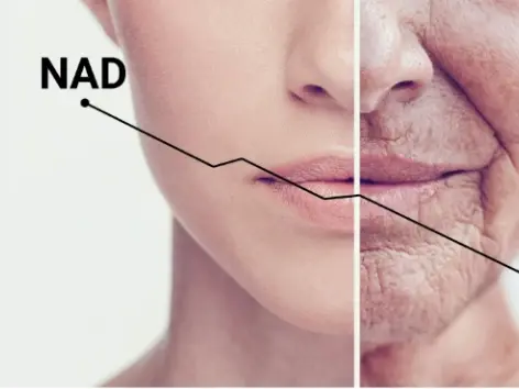 NAD Nedir ve Neden Önemlidir?